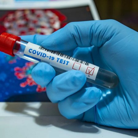 Ministerstwo Zdrowia kupiło 2 mln testów antygenowych po 21 zł netto za sztukę