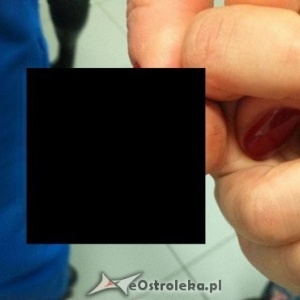 Horror w oddziale przedszkolnym w Olszewie-Borkach. Sześciolatek odgryzł palec rówieśniczce [DRASTYCZNE ZDJĘCIE +18]