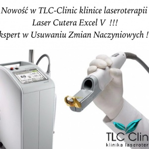 Od Dziś Naczynka na Twarzy&nbsp;&nbsp;i Nogach to już Przeszłość !!! LASER EXCEL V w TLC!!!