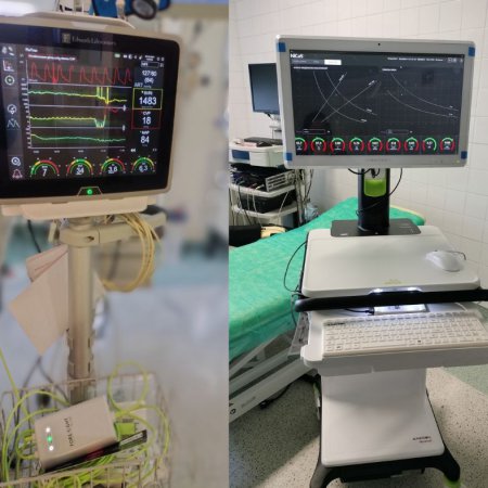 Szpital w Ostrołęce inwestuje w nowoczesną aparaturę ratunkową [ZDJĘCIA]