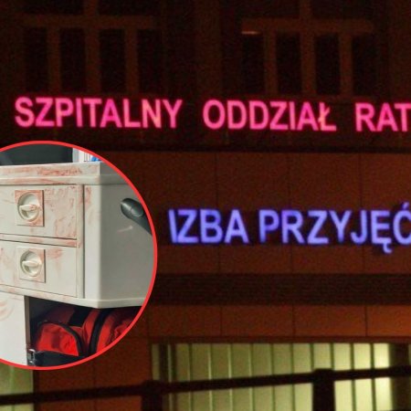 Krwawy finał imprezy karnawałowej. 37-latka pogryzła ratownika i policjanta!