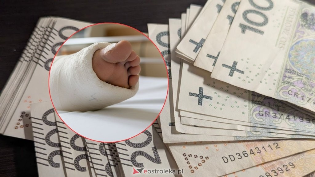 Złamanie nogi na śliskim chodniku? Odbierz 100% pensji z ZUS!