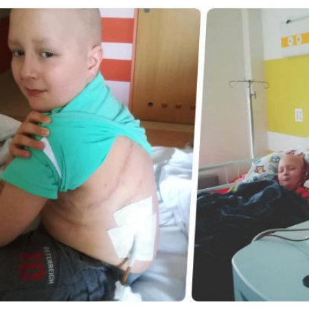 "Dramat dziecka na onkologii". Trwa zbi&#243;rka funduszy na leczenie 10-letniego Krzysia